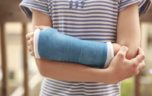 Как можно снять отек руки после перелома?