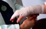 Диагностика и лечение перелома лучевой кости