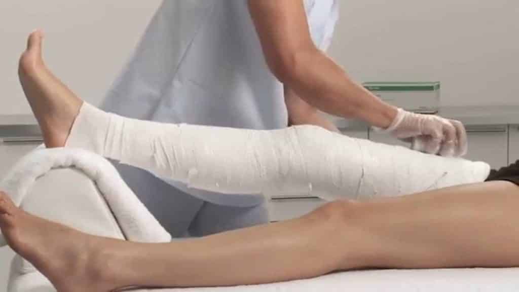 Иммобилизация пациента при переломах