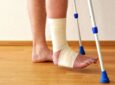 Лечение перелома лодыжки со смещением: операция с пластиной