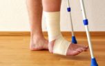 Лечение перелома лодыжки со смещением: операция с пластиной
